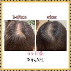 【育毛ヘッドスパ】Forest〜フォレスト〜毛髪・頭皮改善サロン